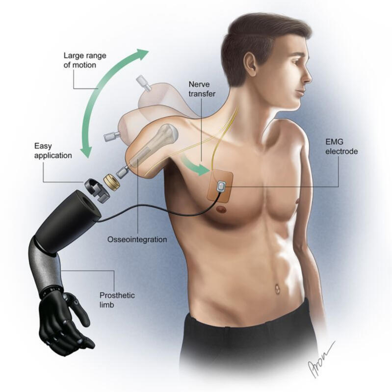 TMR Arm device